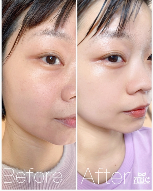 森SHEN評價好用嗎開箱銀杏全能高效賦活霜